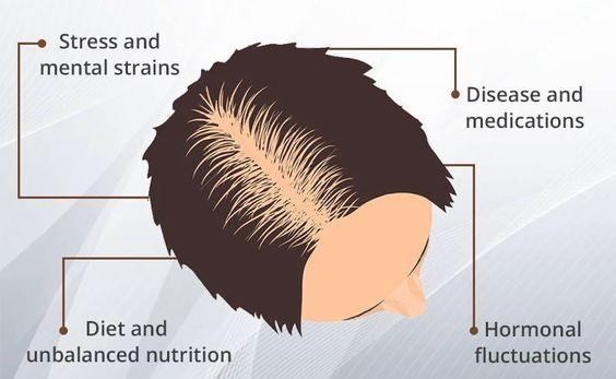 Illustration depicting causes of hair loss